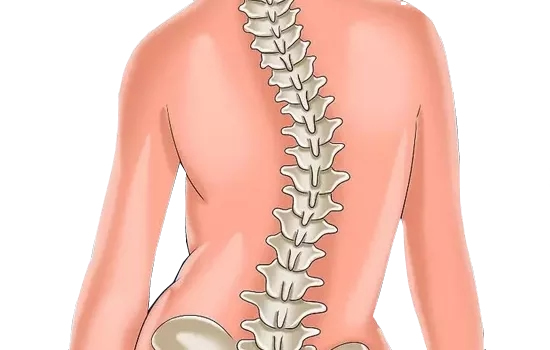 危害青少(shǎo)年身心健康的疾病脊柱側彎