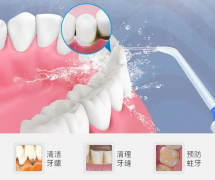 成人多久潔一次牙比較合适